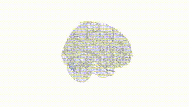 Full Brain White