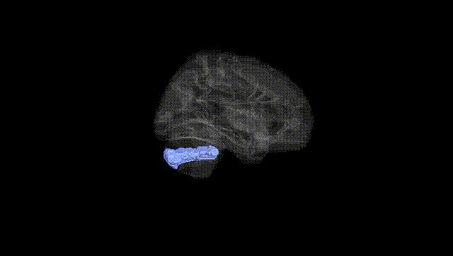 Hemisphere Black