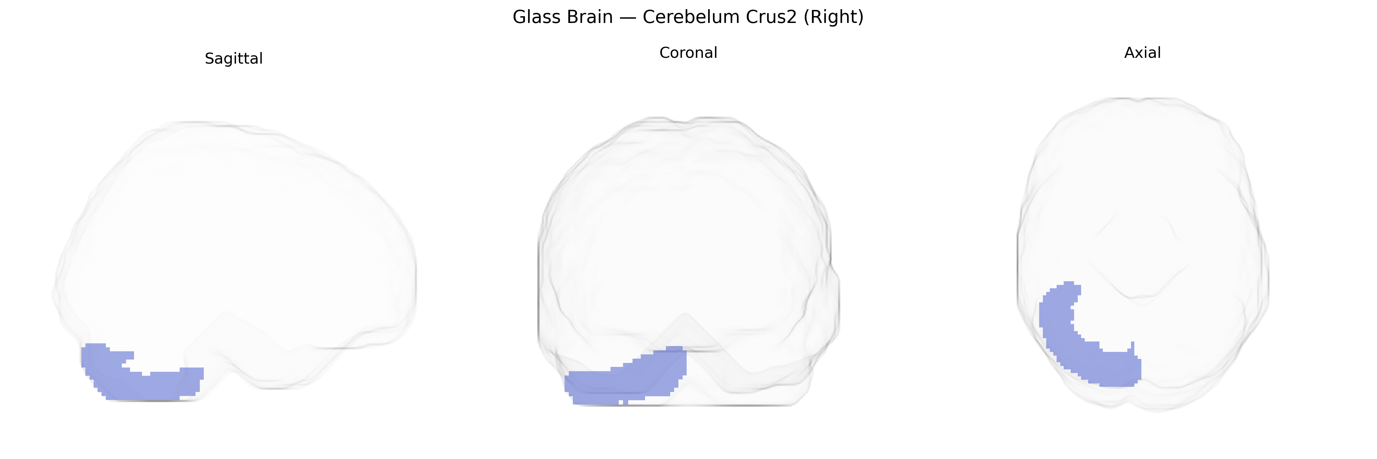 Triplanar Ghost Brain