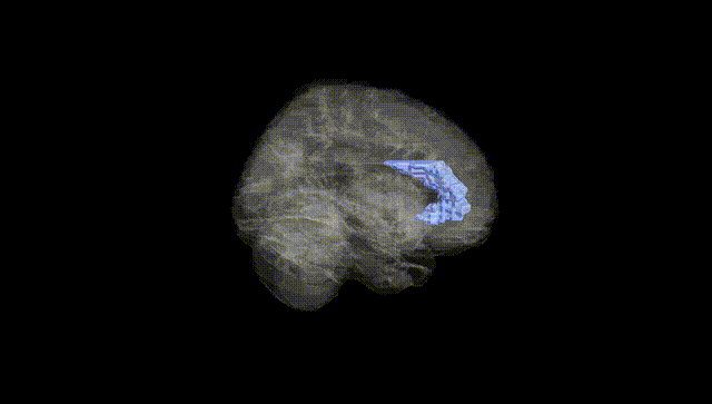Full Brain Black