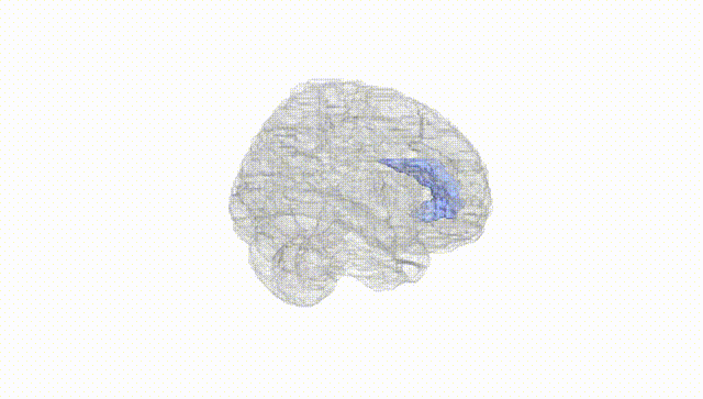 Full Brain White