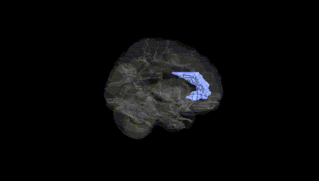 Hemisphere Black