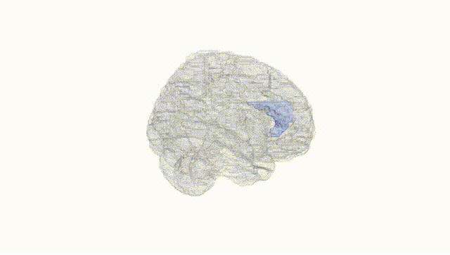 Full Brain White