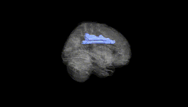 Full Brain Black