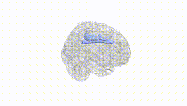 Full Brain White