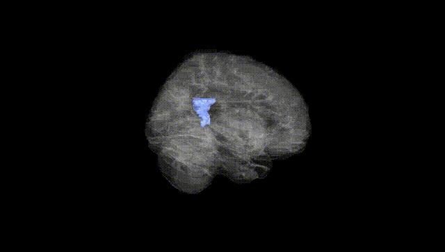 Full Brain Black