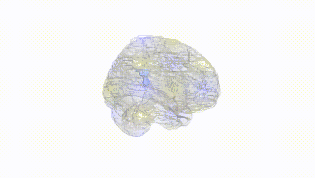 Full Brain White