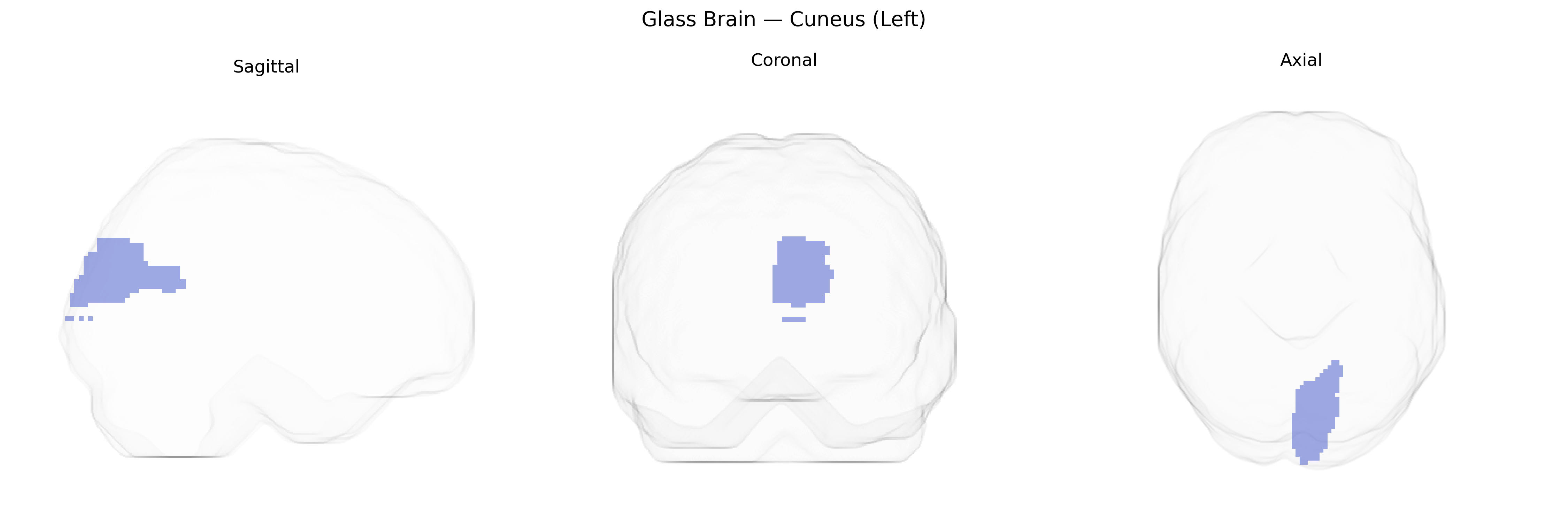 Triplanar Ghost Brain