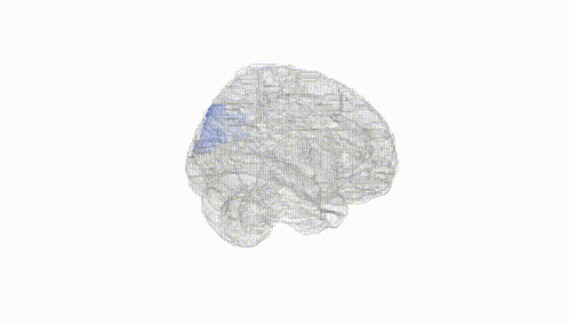 Full Brain White