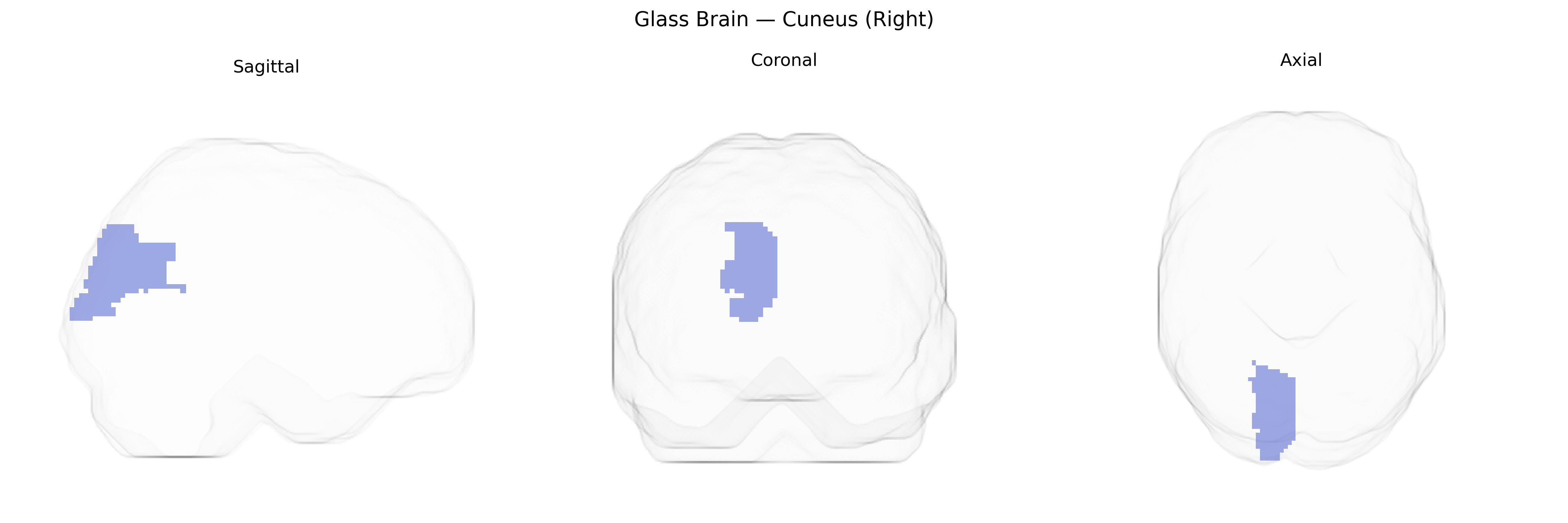 Triplanar Ghost Brain