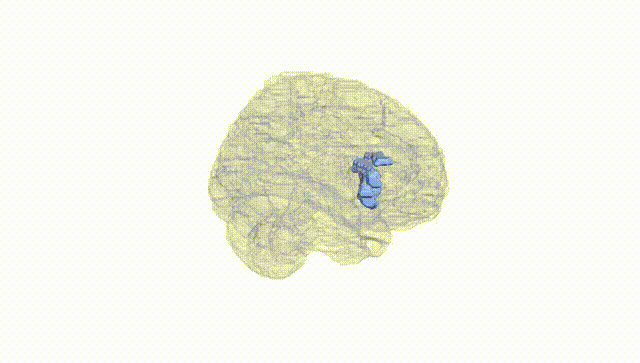 Full Brain White