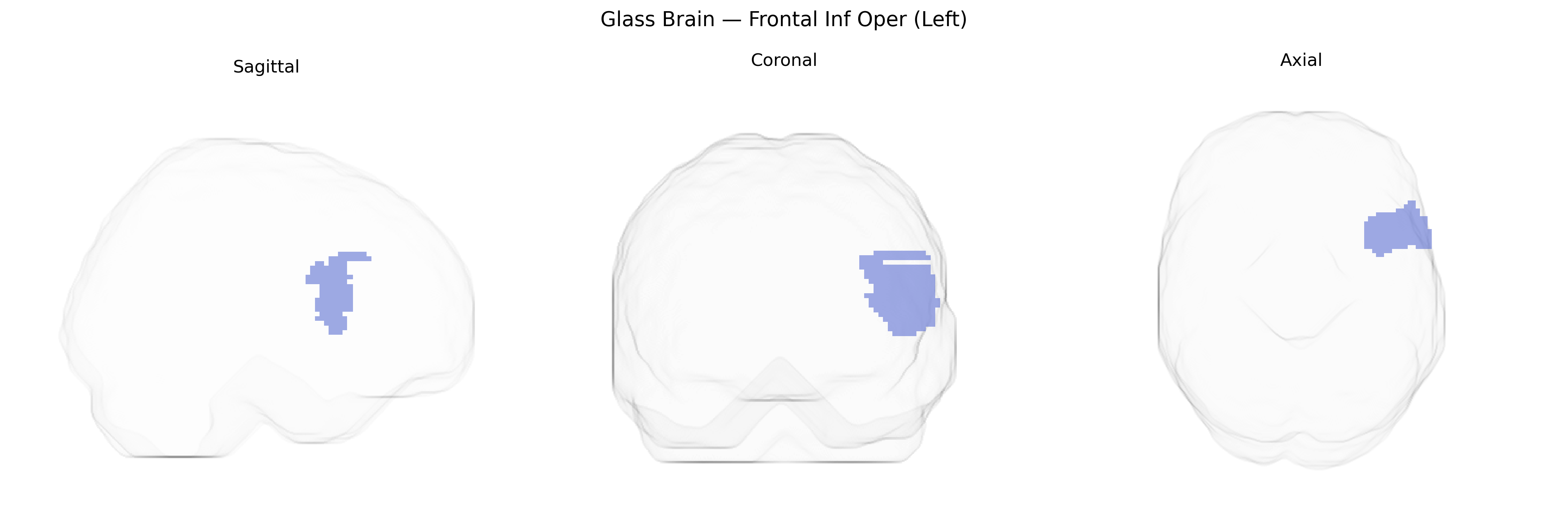 Triplanar Ghost Brain