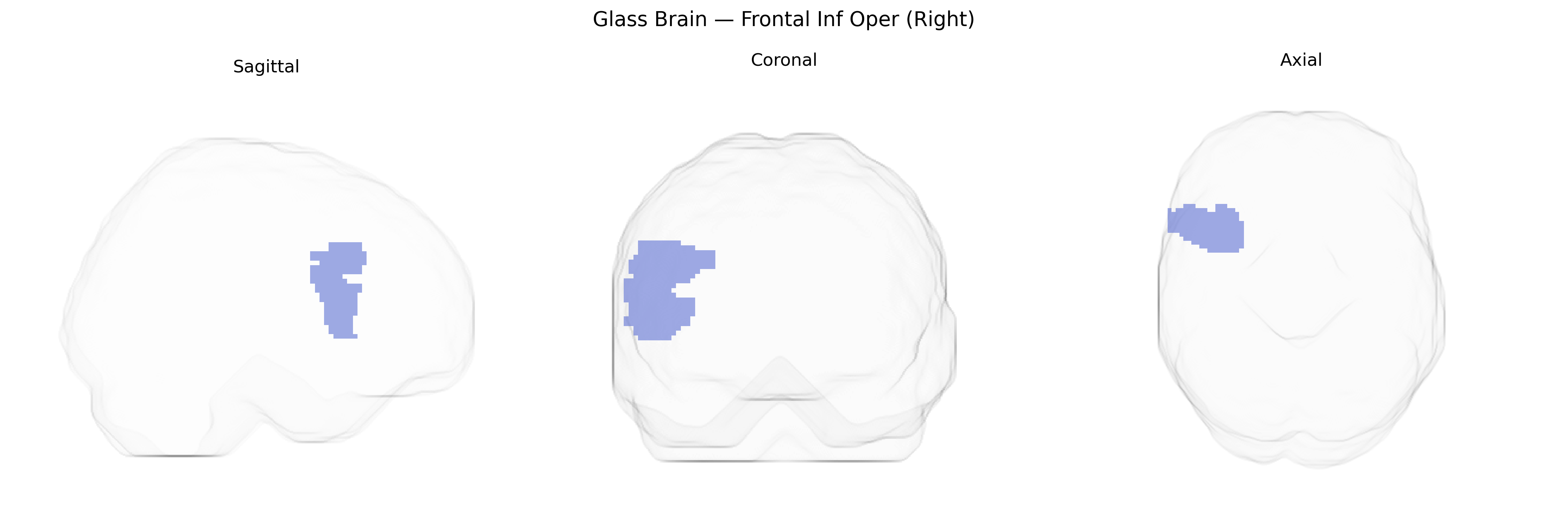 Triplanar Ghost Brain
