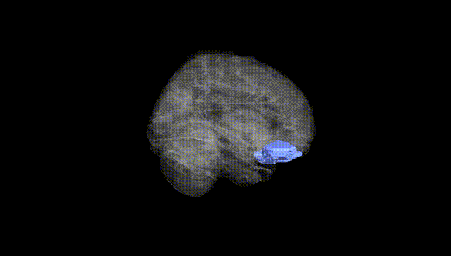 Full Brain Black