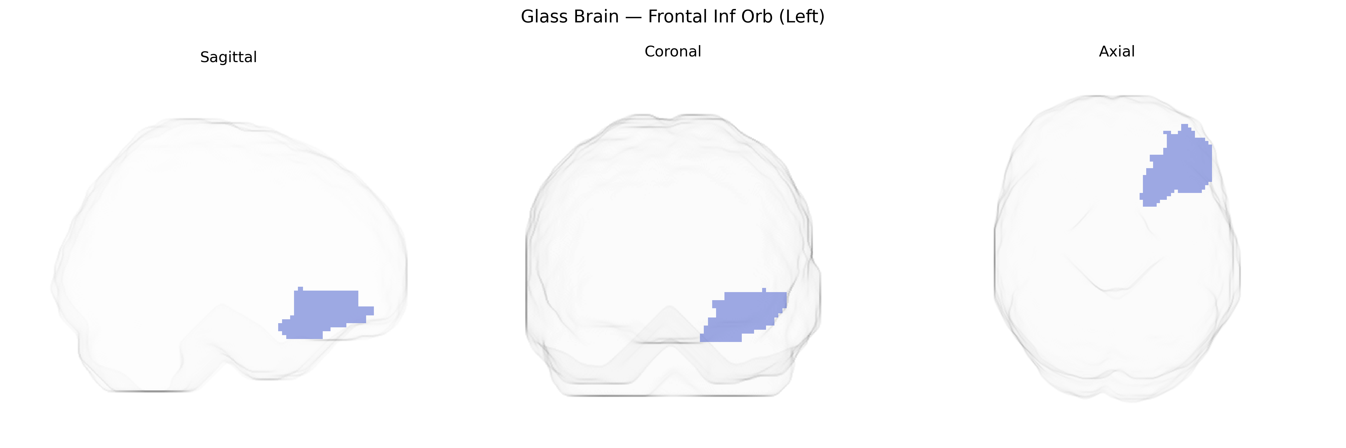 Triplanar Ghost Brain