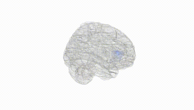 Full Brain White