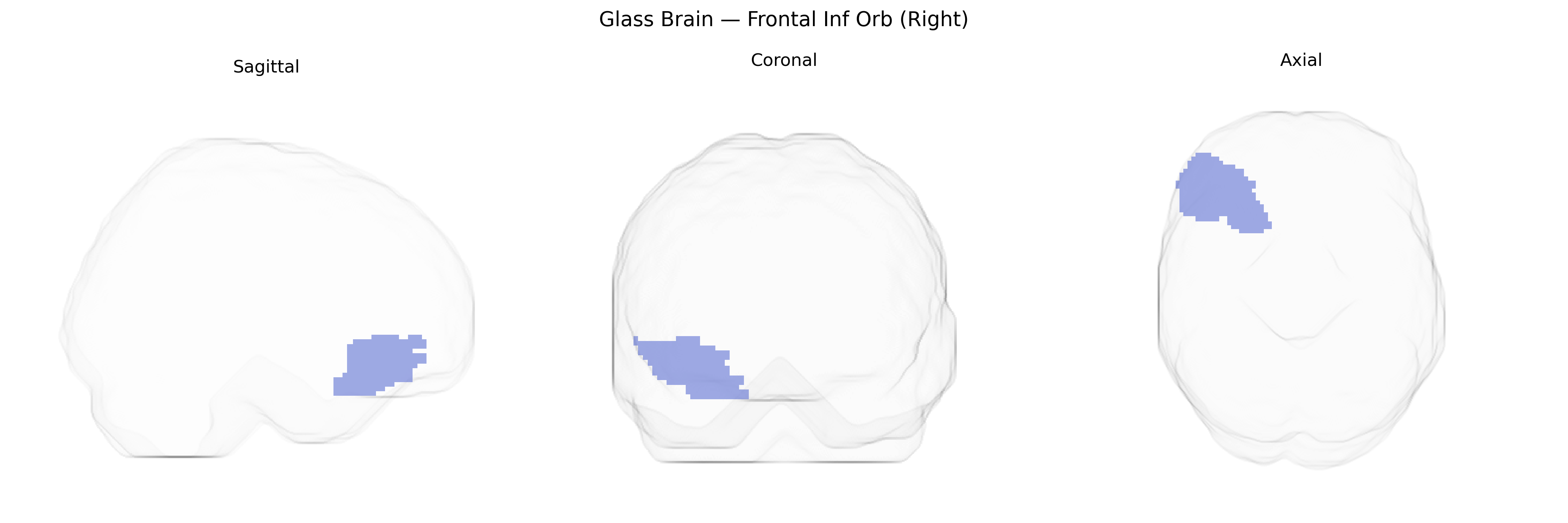 Triplanar Ghost Brain