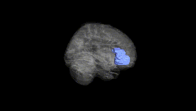 Full Brain Black