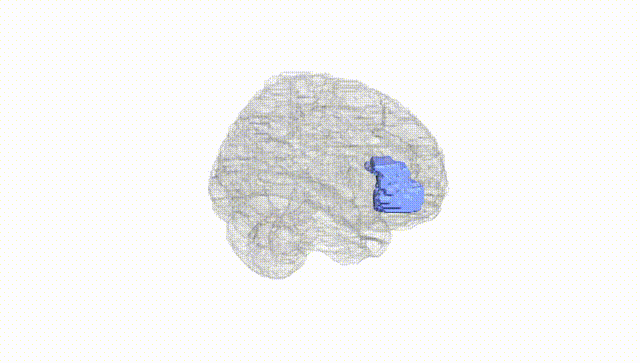 Full Brain White