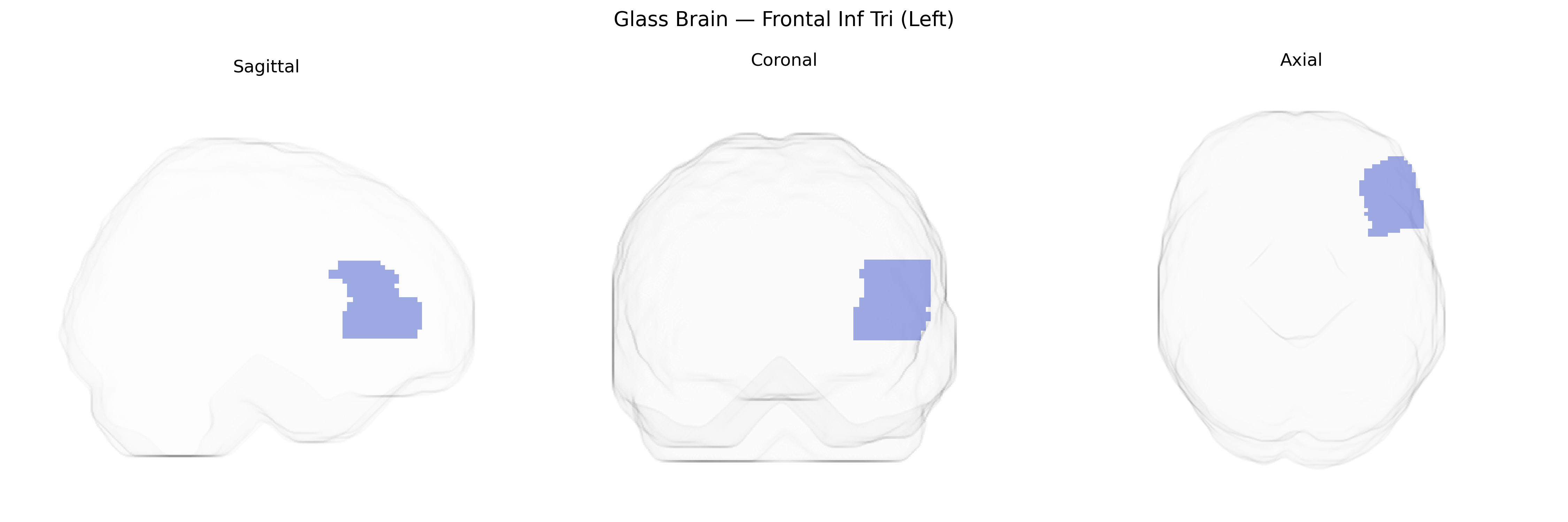 Triplanar Ghost Brain