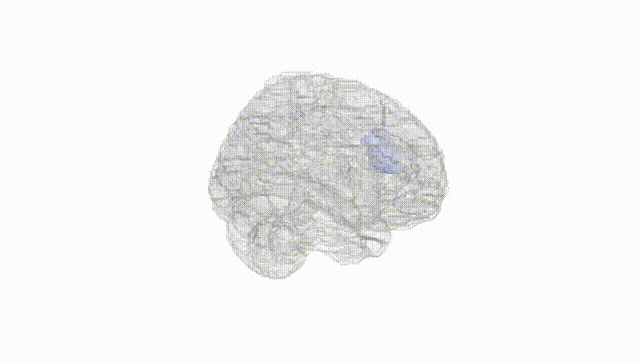 Full Brain White