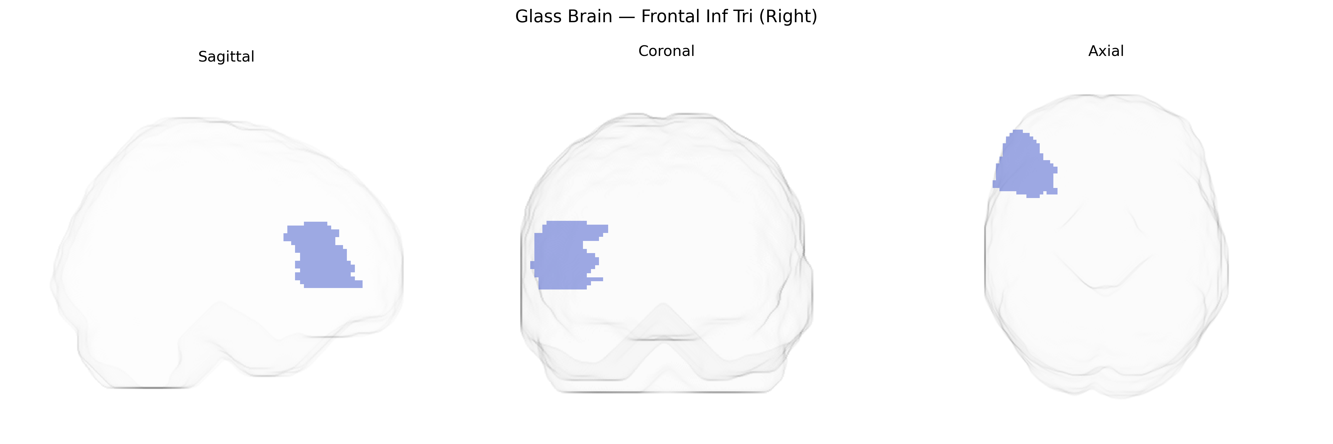 Triplanar Ghost Brain