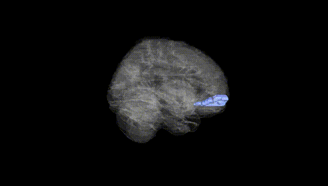 Full Brain Black