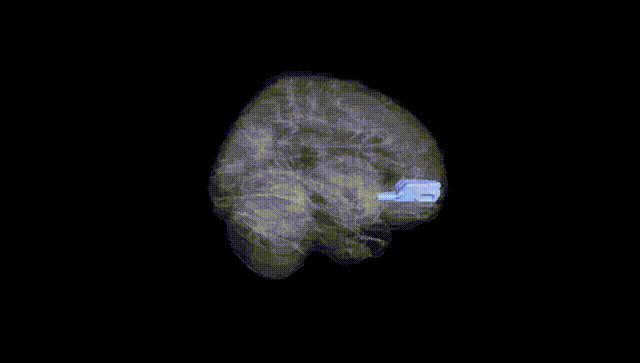 Full Brain Black