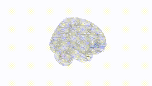 Full Brain White