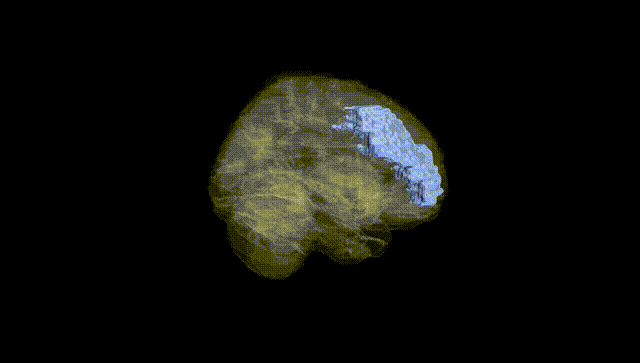 Full Brain Black