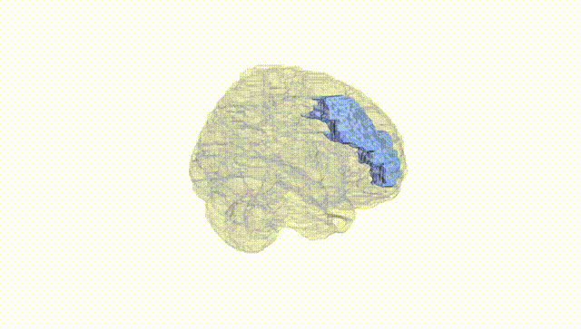 Full Brain White