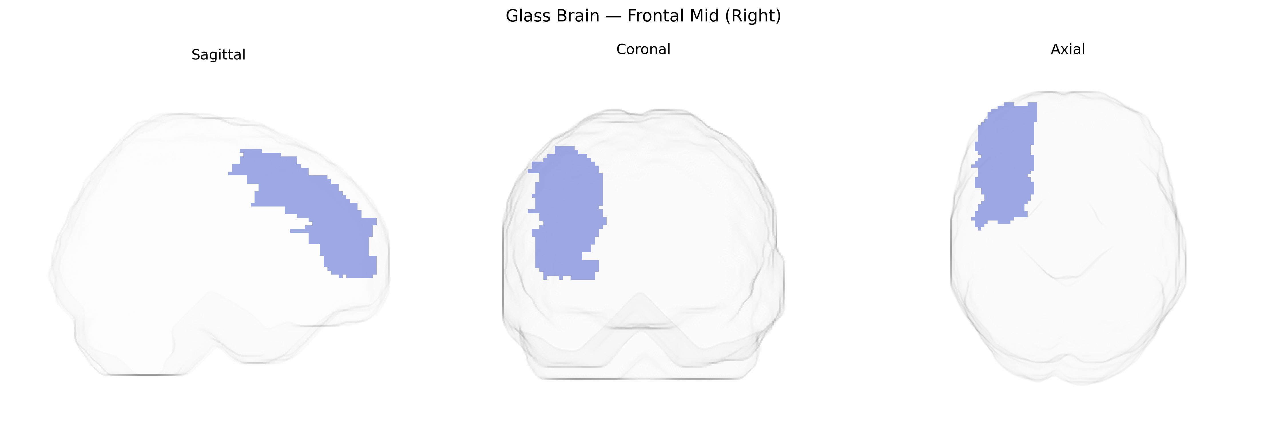 Triplanar Ghost Brain