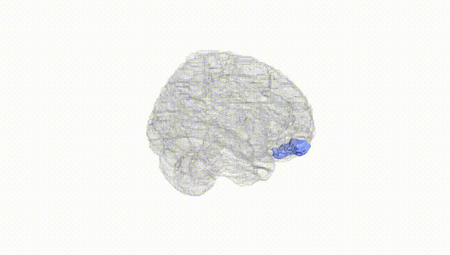 Full Brain White