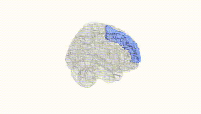 Full Brain White
