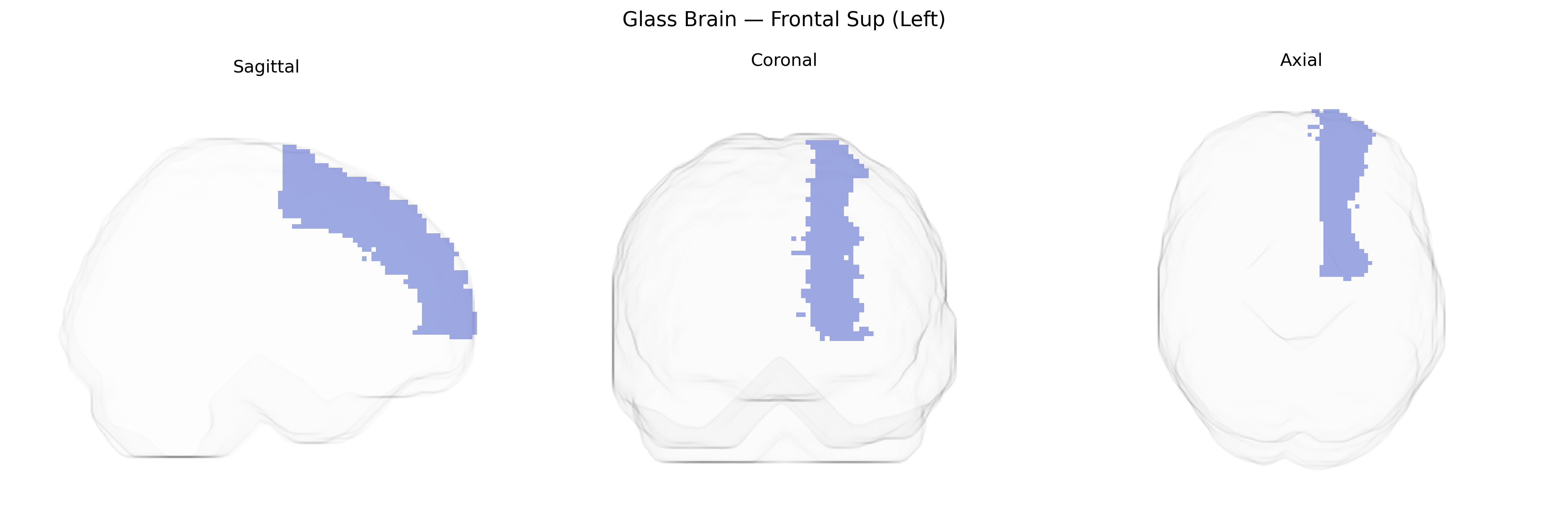 Triplanar Ghost Brain