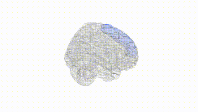 Full Brain White