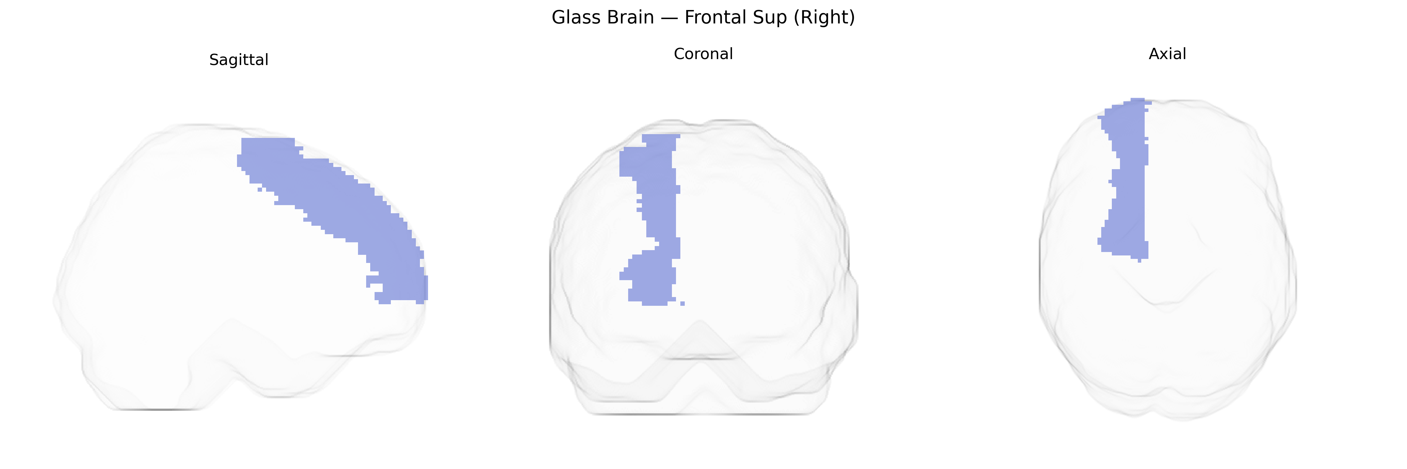 Triplanar Ghost Brain