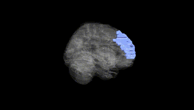 Full Brain Black