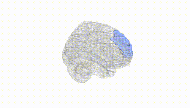 Full Brain White