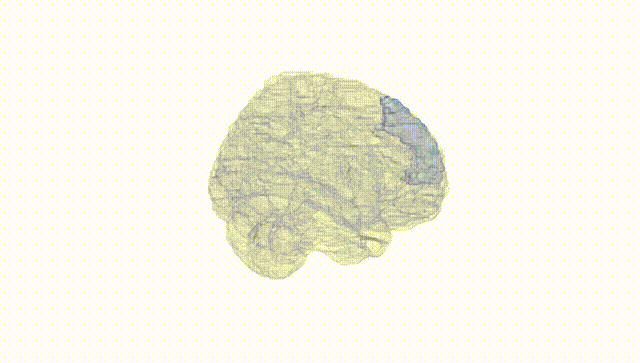 Full Brain White