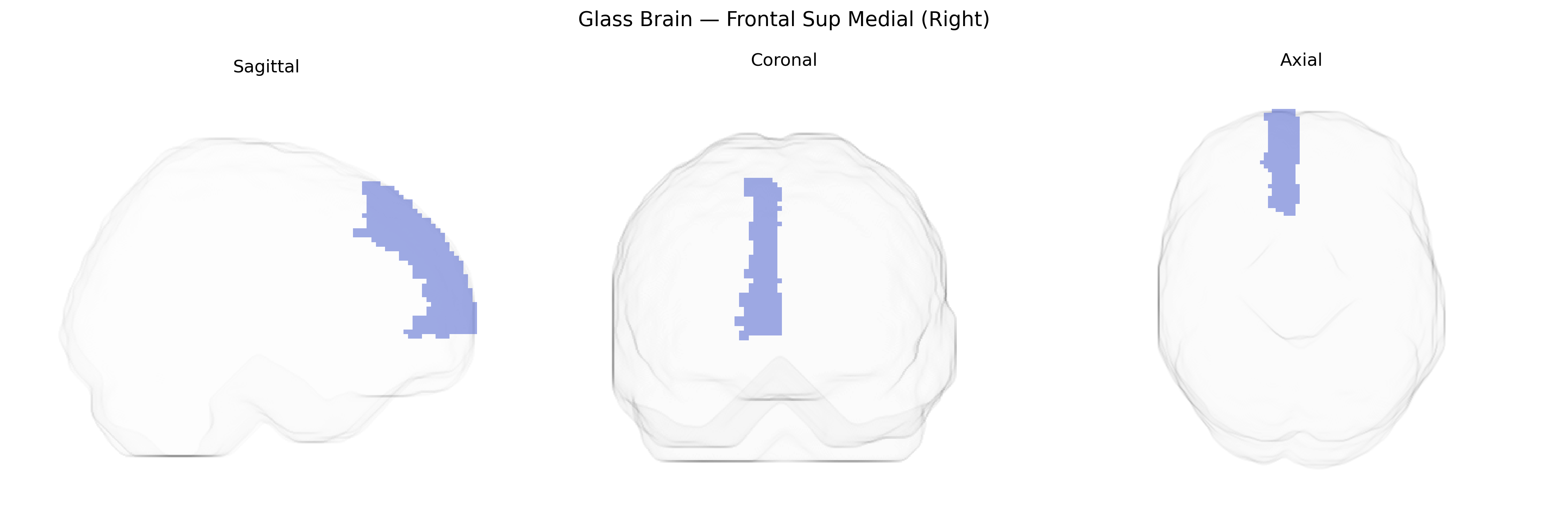 Triplanar Ghost Brain