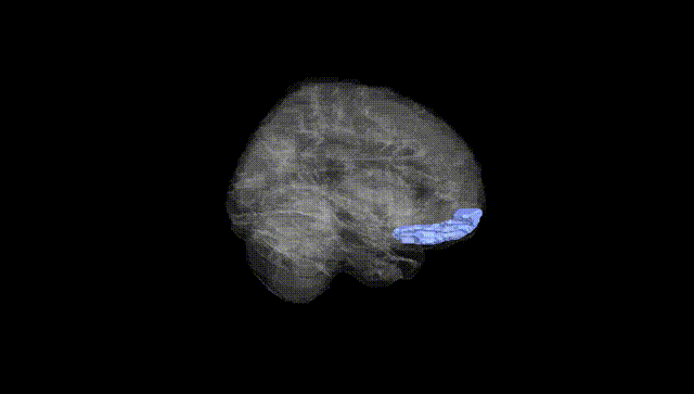 Full Brain Black