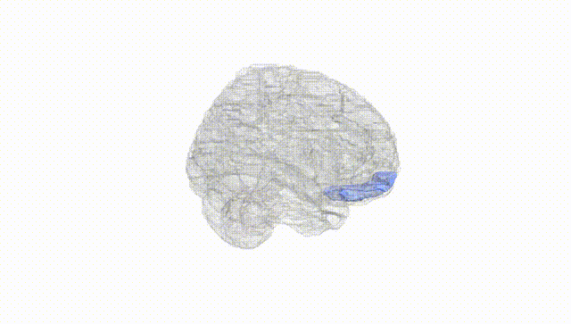 Full Brain White