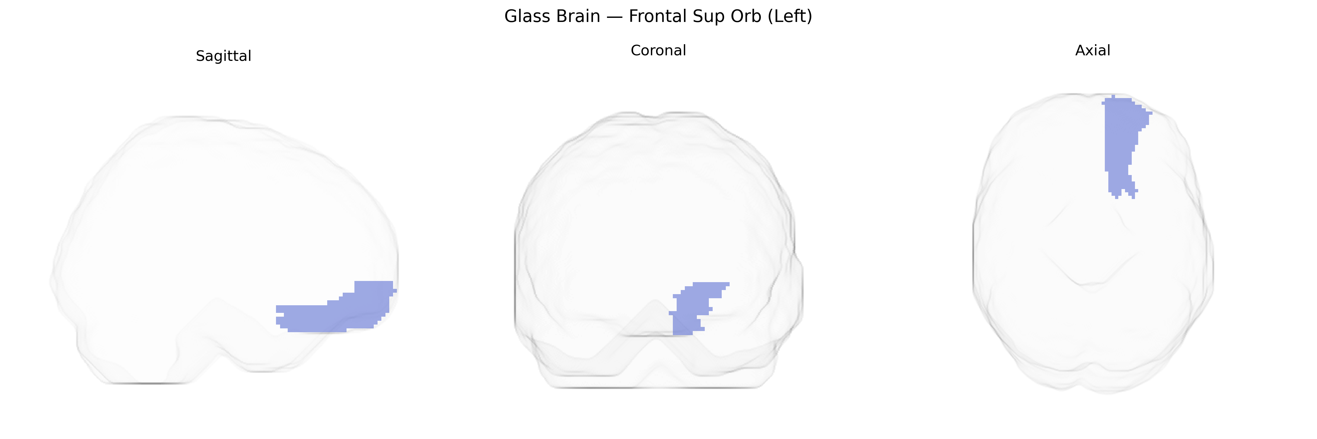 Triplanar Ghost Brain