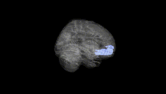 Full Brain Black