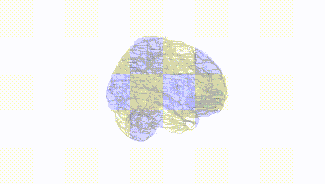 Full Brain White