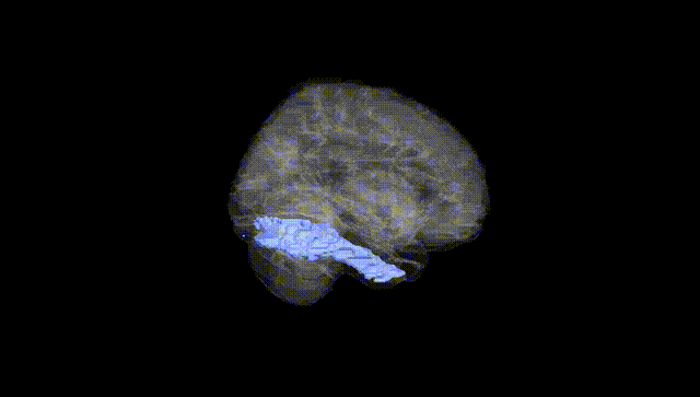 Full Brain Black