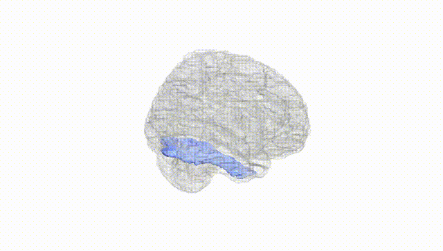Full Brain White