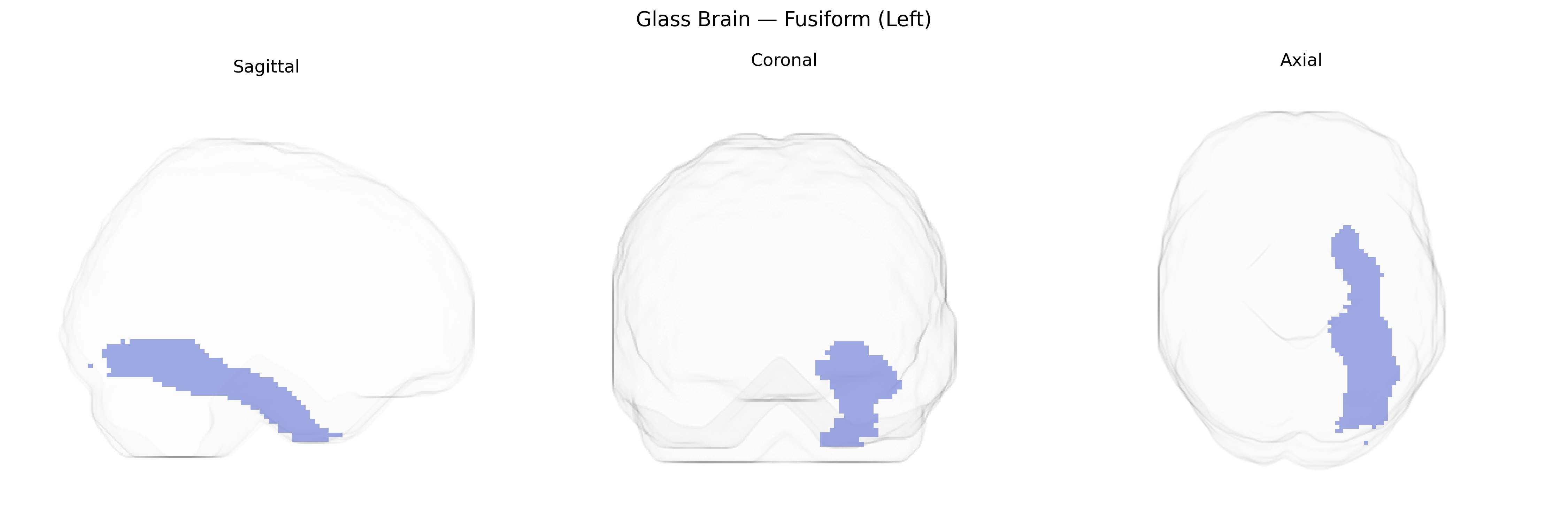 Triplanar Ghost Brain