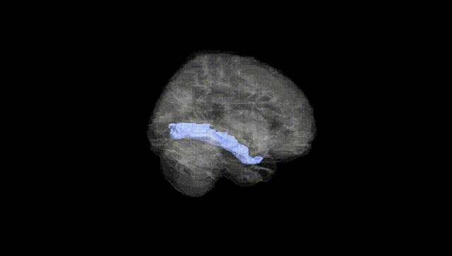 Full Brain Black